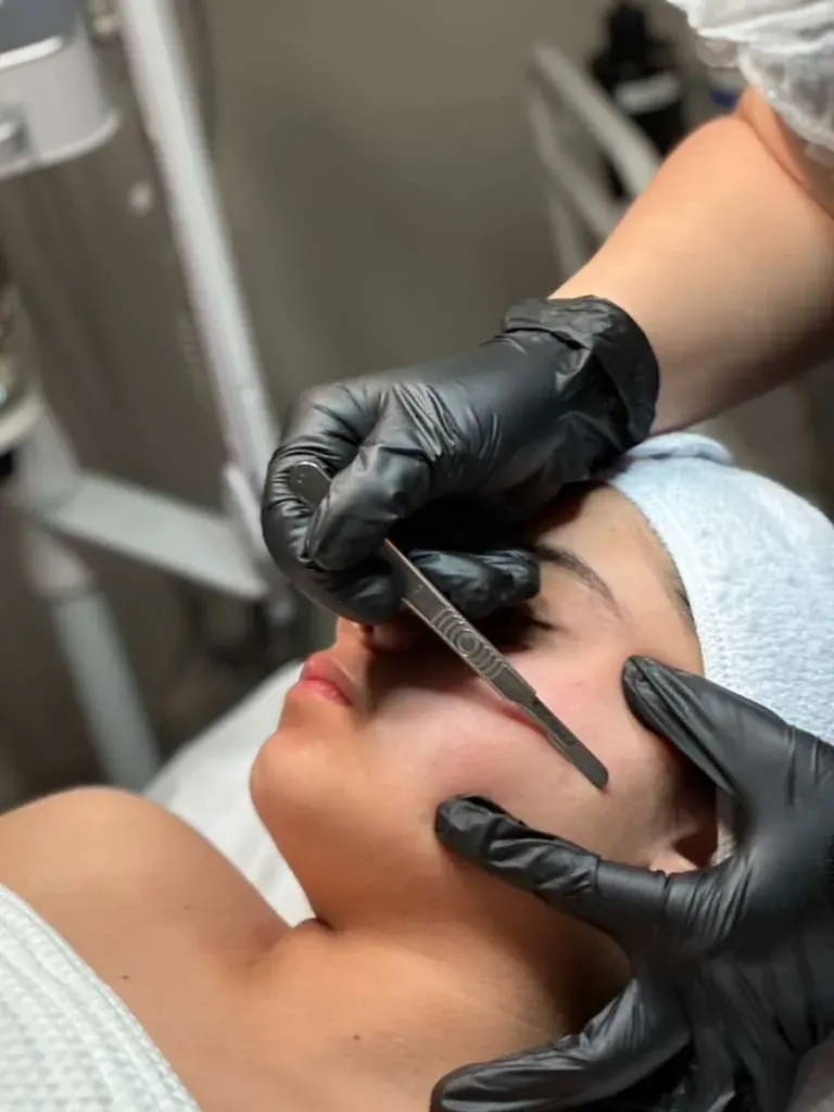 Dermaplaning